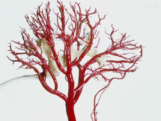 一招清除血管垃圾