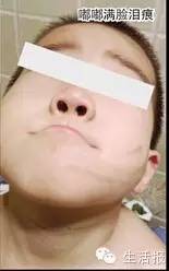 女子斥幼兒園虐打其子