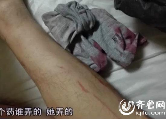 小伙手指斷裂身中“百草枯” 或因前女友報(bào)復(fù)