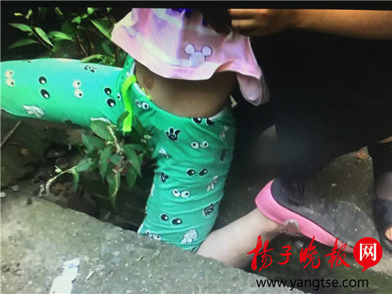 女孩下水道卡住左膝蓋