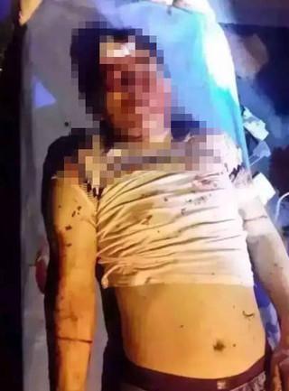 少婦開車撞死人哀求別報警 家人賠130萬善后